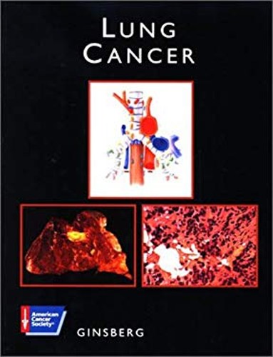 Lung cancer compact disc - lung,