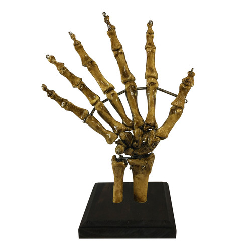 Aged bizarre finger medical - aged,