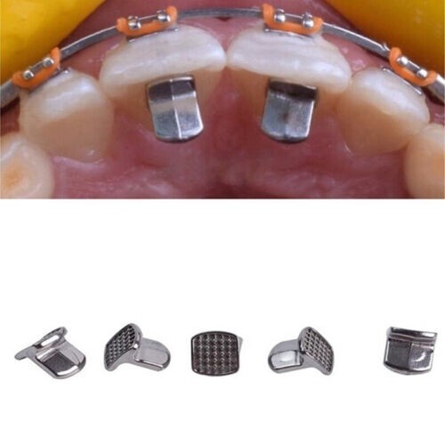 100pcs dental orthodontic mim - 100pcs,