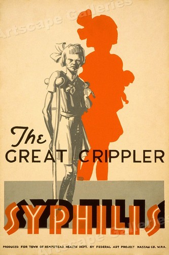 Young girl with - with, syphilis