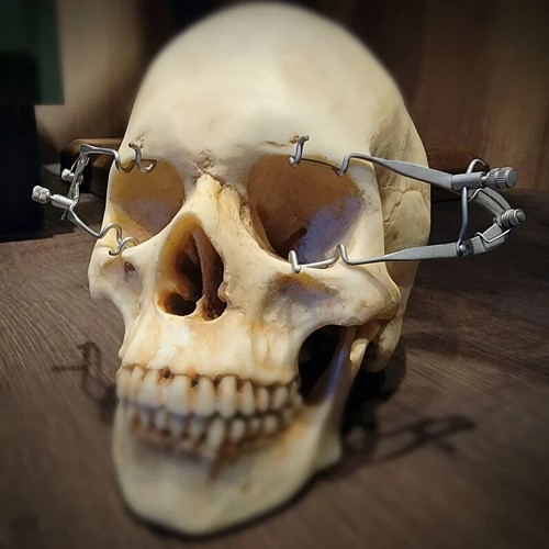 Eye speculum set vintage - x2,