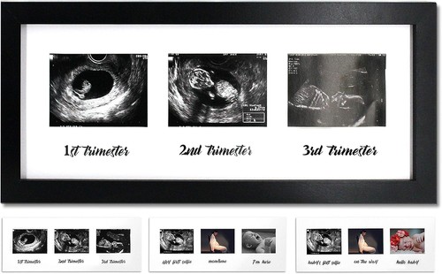 Triple sonogram pregnancy - sonogram,