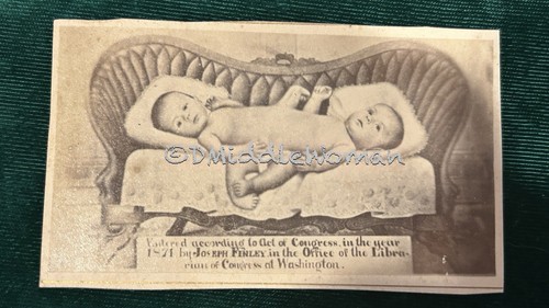 Cdv conjoined twins mina - cdv, &