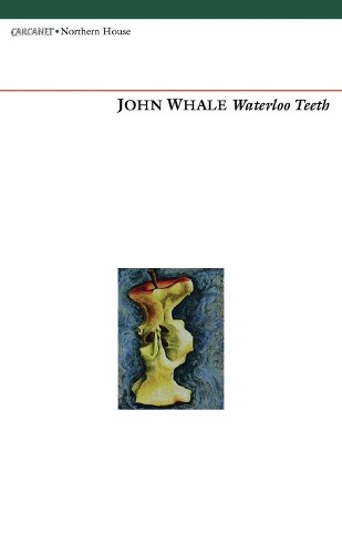 John whale waterloo teeth - john,