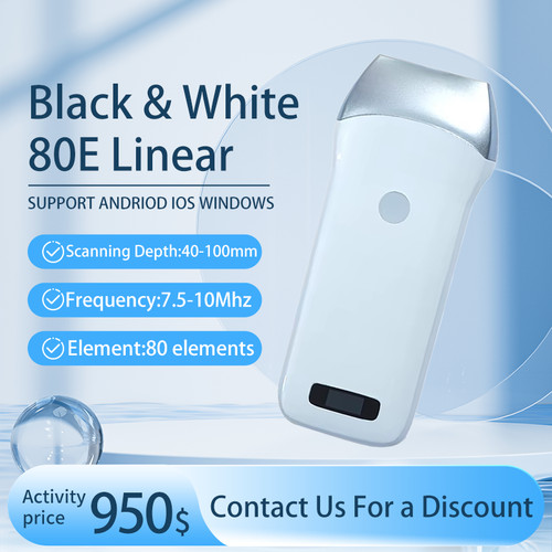 Wireless ultrasound linear - wireless,